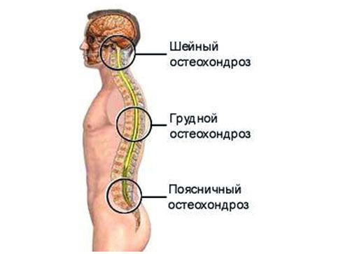 Грудной остеохондроз лечение в домашних условиях гимнастика