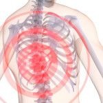 Что делать при остеохондрозе грудного отдела