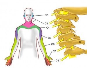 Боли в шее и руке - симптомы вертеброгенной цервикобрахиалгии