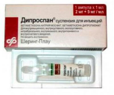 Лфк для поясничного и шейного отдела