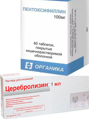 Церебролизин и пентоксифиллин