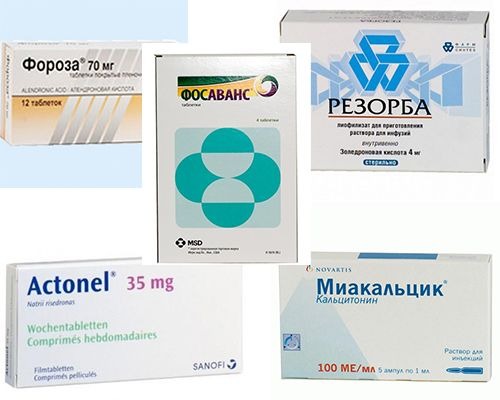 Таблетки от остеопороза: обезболивающие, для профилактики, бонвиа .
