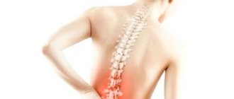 Боли в спине при остеопорозе