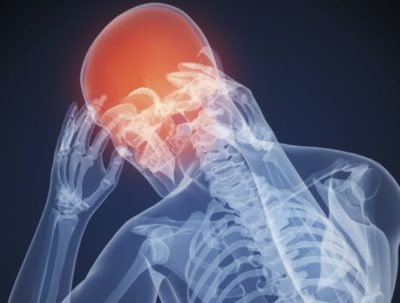 Частые головные боли причины у женщин