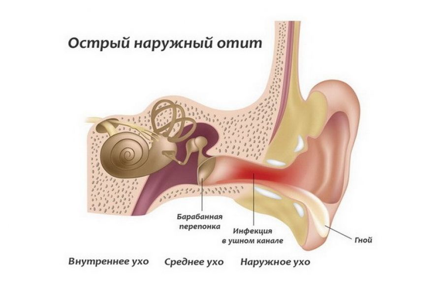 Болит ухо и часть головы при надавливании