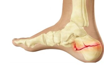 Изображение - Боли в суставах ступни ног лечение Snimok-ekrana-2017-03-18-v-16.25.43