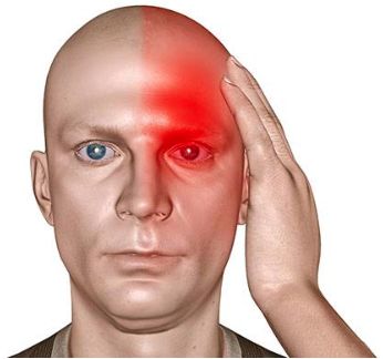 Головная боль усиливающаяся при движениях головой
