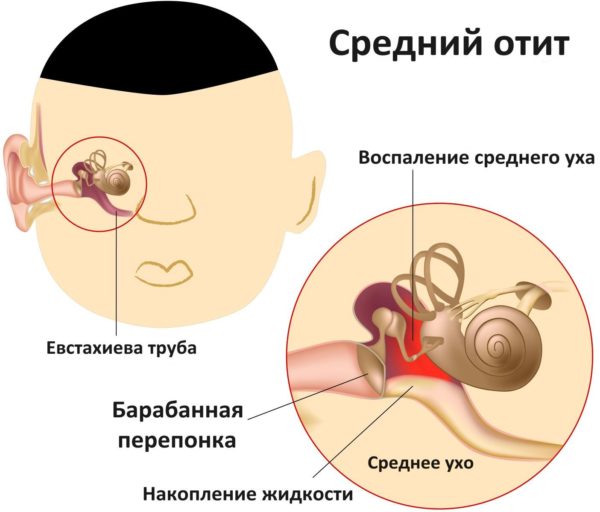 Болит ухо и часть головы при надавливании