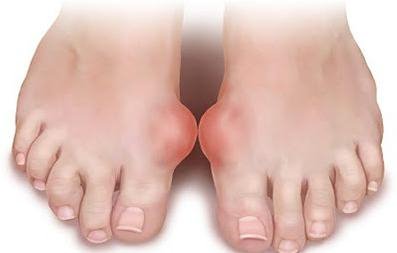 Болит большой палец ноги при движении