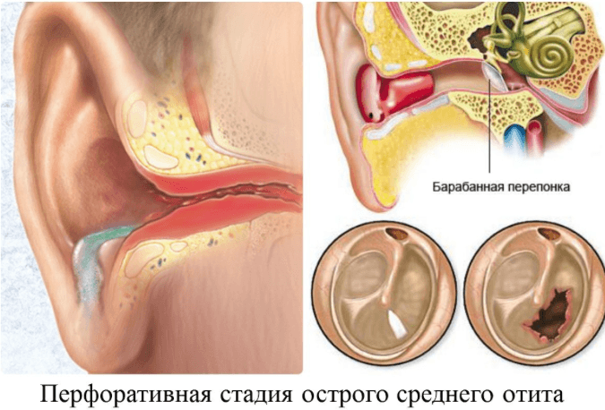 Болит шея голова и область за ушами