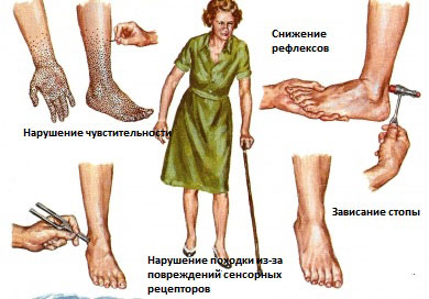 Болит нога от колена и до лодыжки