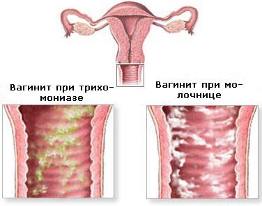 болит поясница нет менструационного цикла