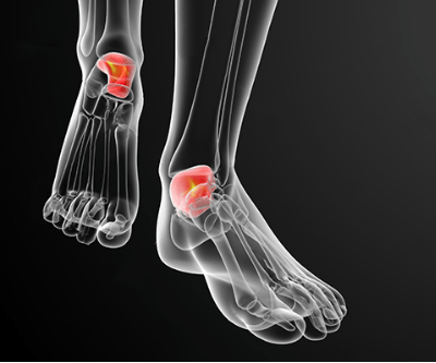 Почему болят кости стопы ног лечение